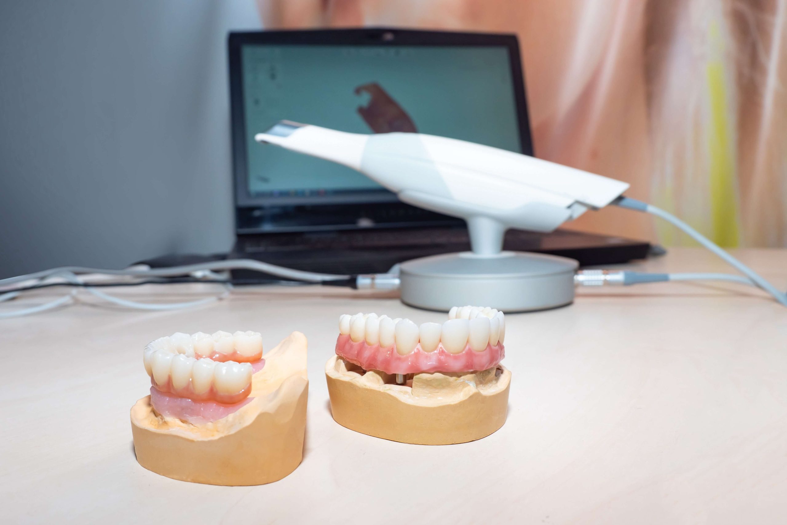 Digital Dentures: Common Misconceptions And Faqs 