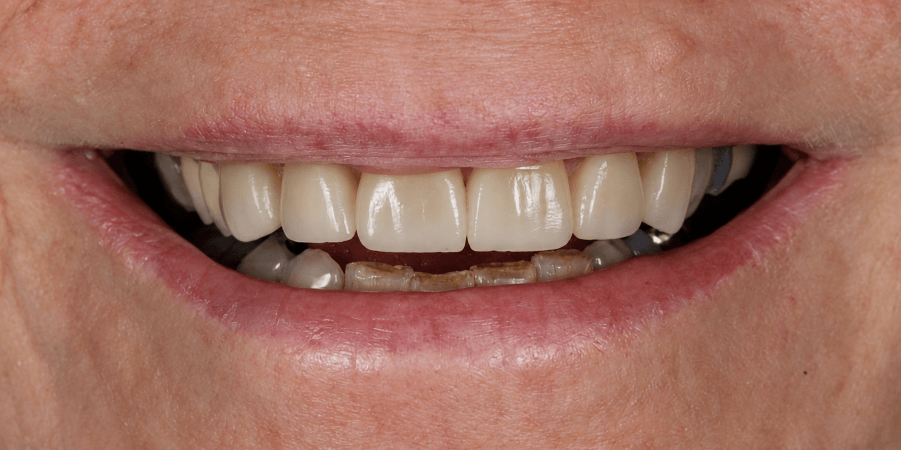 Dr Nguyen Final Outcome image